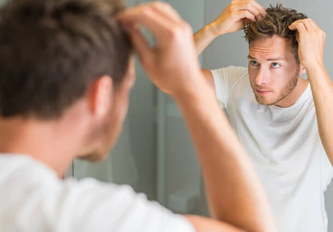 Čo sú lupiny a aké sú ich príčiny