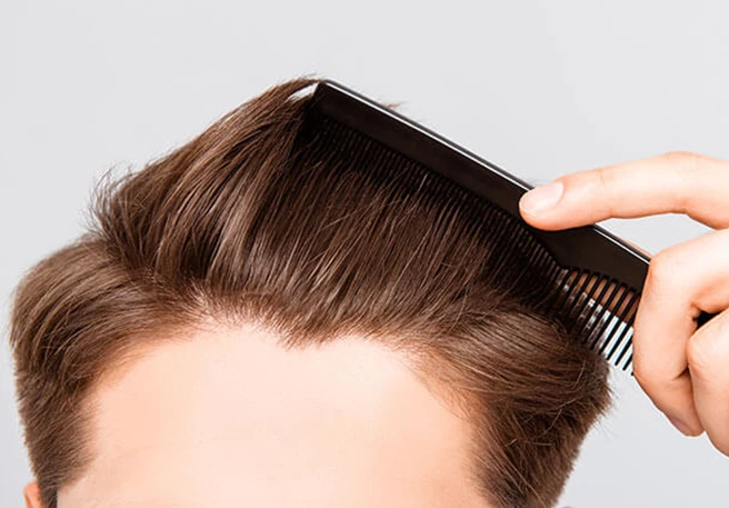 Udržujte svoju hlavu zdravú